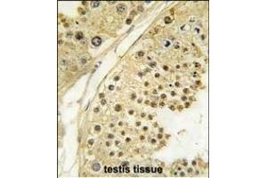 Formalin-fixed and paraffin-embedded human testis tissue reacted with STK12 Antibody (N-term) (ABIN391353 and ABIN2841374) , which was peroxidase-conjugated to the secondary antibody, followed by DAB staining. (Aurora-B (ARK/STK12) (AA 6-35), (N-Term) Antikörper)