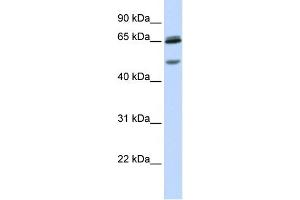 WB Suggested Anti-GABRG2 Antibody Titration:  0. (GABRG2 Antikörper  (N-Term))