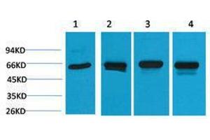 Western Blotting (WB) image for anti-Heat Shock 60kDa Protein 1 (Chaperonin) (HSPD1) antibody (ABIN3181507) (HSPD1 Antikörper)