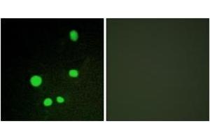 Immunofluorescence analysis of COS7 cells, using MED14 Antibody. (MED14 Antikörper  (AA 701-750))