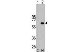 Image no. 1 for anti-Myc Proto-Oncogene protein (MYC) antibody (ABIN357363) (c-MYC Antikörper)