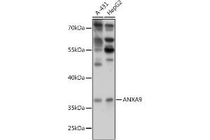 Western blot analysis of extracts of various cell lines, using  antibody (ABIN7265625) at 1:1000 dilution. (Annexin A9 Antikörper  (AA 1-100))