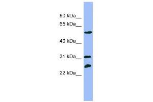 PSMC4 antibody used at 1 ug/ml to detect target protein. (PSMC4 Antikörper)