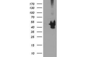 Western Blotting (WB) image for anti-Potassium Voltage-Gated Channel, Shaker-Related Subfamily, beta Member 1 (KCNAB1) antibody (ABIN1499001) (KCNAB1 Antikörper)