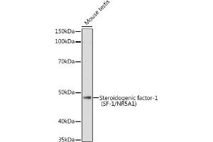 Western blot analysis of extracts of Mouse testis, using Steroidogenic factor-1 (SF-1/NR5) antibody (657) at 1:1000 dilution. (NR5A1 Antikörper  (AA 1-120))