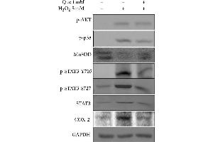 Effects of quercetin on the inflammatory response in H2O2-treated H9C2 cells. (PTGS2 Antikörper  (C-Term))