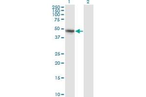 Western Blot analysis of CBLC expression in transfected 293T cell line by CBLC monoclonal antibody (M01), clone 3F10. (CBLC Antikörper  (AA 1-474))