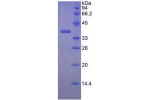 SDS-PAGE analysis of Mouse Lumican Protein.