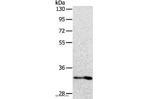 Western blot analysis of Human fetal intestine tissue, using IL1RL1 Polyclonal Antibody at dilution of 1:700 (IL1RL1 Antikörper)