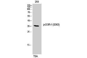 Western Blotting (WB) image for anti-Opioid Receptor, delta 1 (OPRD1) (pSer363) antibody (ABIN3182512) (OPRD1 Antikörper  (pSer363))