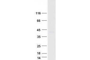 SLC30A7 Protein (Transcript Variant 1) (Myc-DYKDDDDK Tag)