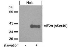 Image no. 3 for anti-Eukaryotic Translation Initiation Factor 2 Subunit 1 (EIF2S1) (pSer49) antibody (ABIN319275) (EIF2S1 Antikörper  (pSer49))