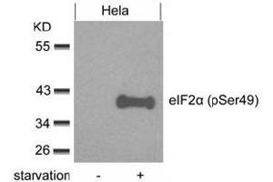 Image no. 3 for anti-Eukaryotic Translation Initiation Factor 2 Subunit 1 (EIF2S1) (pSer49) antibody (ABIN319276) (EIF2S1 Antikörper  (pSer49))