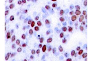 Image no. 1 for anti-Jun Proto-Oncogene (JUN) antibody (ABIN265353) (C-JUN Antikörper)
