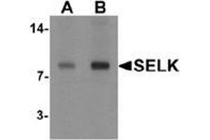 Western blot analysis of SELK in A20 cell lysate with SELK antibody at (A) 1 and (B) 2 μg/ml. (Selenoprotein K Antikörper  (C-Term))