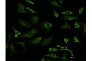 Immunofluorescence of monoclonal antibody to PCBP2 on HeLa cell.
