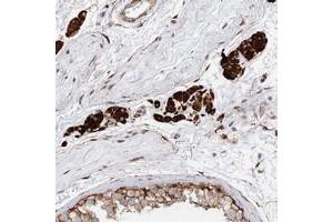 Immunohistochemical staining of human testis with LRRC56 polyclonal antibody  shows strong cytoplasmic positivity in Leydig cells at 1:200-1:500 dilution. (LRRC56 Antikörper)