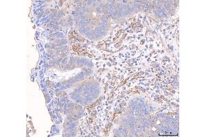 IHC analysis of ANGPT2 using anti-ANGPT2 antibody (ABIN3043725).