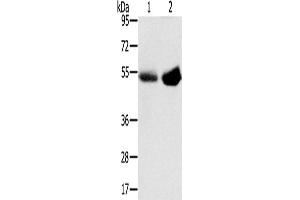 Western Blotting (WB) image for anti-Solute Carrier Family 13 Member 3 (SLC13A3) antibody (ABIN2427263) (SLC13A3 Antikörper)