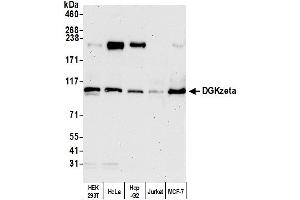 Western Blotting (WB) image for anti-Diacylglycerol Kinase, zeta (DGKZ) (AA 1067-1117) antibody (ABIN7454557) (DGKZ Antikörper  (AA 1067-1117))