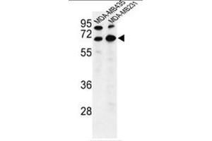 Western blot analysis of BEST2 Antibody (C-term) in MDA-MB435,MDA-MB231 cell line lysates (35µg/lane). (Bestrophin 2 Antikörper  (C-Term))