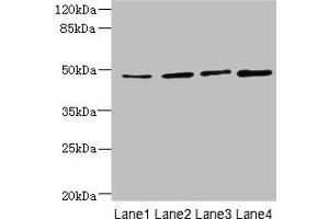 Western blot All lanes: TTC5 antibody at 6 μg/mL Lane 1: HepG2 whole cell lysate Lane 2: A549 whole cell lysate Lane 3: MCF-7 whole cell lysate Lane 4: Mouse kidney tissue Secondary Goat polyclonal to rabbit IgG at 1/10000 dilution Predicted band size: 49 kDa Observed band size: 49 kDa (TTC5 Antikörper  (AA 201-440))