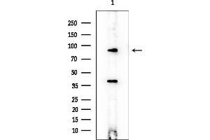 Western blot analysis of lysates from EC304 cells, using HGF Mouse Monoclonal Antibody at 1/1000 dilution.