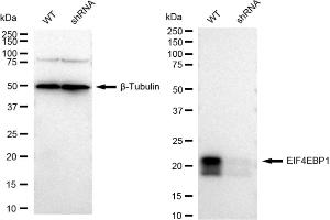 Western blotting analysis using EIF4EBP1 antibody (ABIN7798531). (Rekombinanter eIF4EBP1 Antikörper)