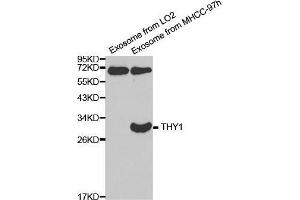 Western blot analysis of extracts of exosome from various cell lines, using THY1 antibody. (CD90 Antikörper  (AA 20-130))