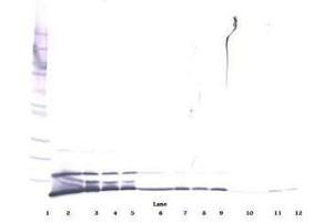 Image no. 2 for anti-Chemokine (C-X-C Motif) Ligand 1 (Melanoma Growth Stimulating Activity, Alpha) (CXCL1) antibody (ABIN464980) (CXCL1 Antikörper)