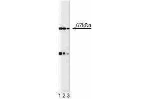 Western blot analysis of p67 [phox] on a EB-1 cell lysate (Human B lymphoblast, Burkitt's lymphoma, ATCC HTB-60). (NCF2 Antikörper  (AA 317-469))