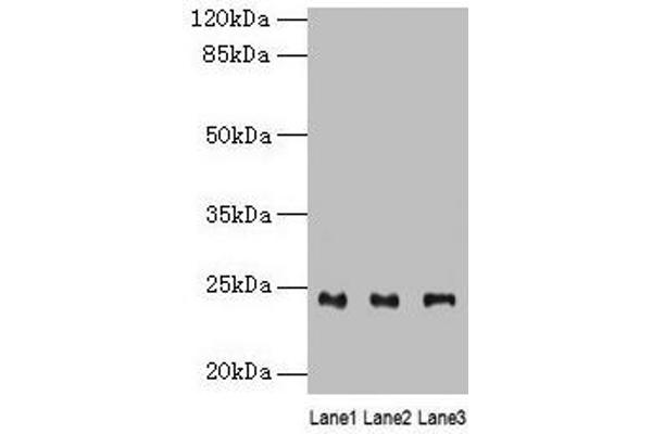 RAB4B Antikörper  (AA 2-213)