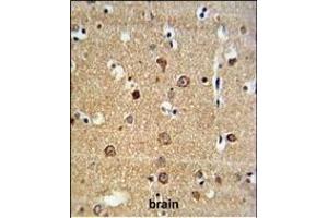 AD Antibody (Center) (ABIN653772 and ABIN2843064) IHC analysis in formalin fixed and paraffin embedded brain tissue followed by peroxidase conjugation of the secondary antibody and DAB staining. (ADAM19 Antikörper  (AA 207-236))