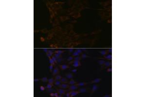 Immunofluorescence analysis of NIH-3T3 cells using HSP Rabbit mAb (ABIN1679173, ABIN3015940, ABIN3015941 and ABIN7101465) at dilution of 1:100 (40x lens). (HSPA14 Antikörper)