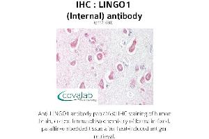 Image no. 1 for anti-Leucine Rich Repeat and Ig Domain Containing 1 (LINGO1) (Internal Region) antibody (ABIN1736453) (LINGO1 Antikörper  (Internal Region))