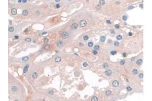 Detection of APOA1 in Human Kidney Tissue using Monoclonal Antibody to Apolipoprotein A1 (APOA1) (APOA1 Antikörper  (AA 122-267))