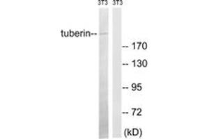 Western Blotting (WB) image for anti-Tuberous Sclerosis 2 (TSC2) (AA 947-996) antibody (ABIN2889165) (Tuberin Antikörper  (AA 947-996))