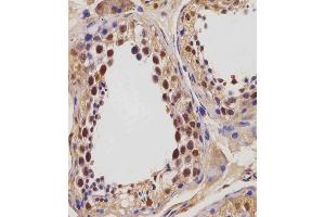 Immunohistochemistry (Paraffin-embedded Sections) (IHC (p)) image for anti-Insulin-Like Growth Factor 2 mRNA Binding Protein 1 (IGF2BP1) (AA 508-534), (C-Term) antibody (ABIN654423)