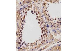 (ABIN654423 and ABIN2844158) staining IGF2BP1 in human testis tissue sections by Immunohistochemistry (IHC-P - paraformaldehyde-fixed, paraffin-embedded sections).