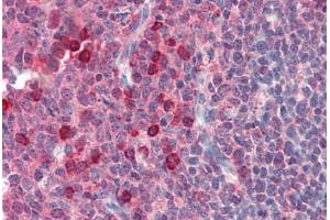 Human Tonsil (formalin-fixed, paraffin-embedded) stained with EXOC3 antibody ABIN364382 at 10 ug/ml followed by biotinylated anti-mouse IgG secondary antibody ABIN481714, alkaline phosphatase-streptavidin and chromogen. (EXOC3 Antikörper)