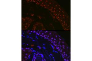Immunofluorescence (IF) image for anti-Tumor Protein P73 (TP73) (AA 1-100) antibody (ABIN6149430)