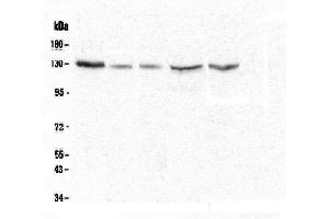 Western blot analysis of CASR using anti-CASR antibody (ABIN5693096).