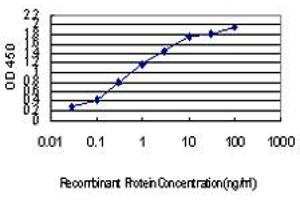 Detection limit for recombinant GST tagged IRX5 is approximately 0. (IRX5 Antikörper  (AA 204-264))