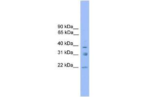 WB Suggested Anti-RNF167 Antibody Titration: 0.