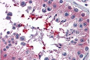 Immunohistochemistry (IHC) image for anti-ATP-Binding Cassette, Sub-Family D (Ald), Member 4 (ABCD4) (Internal Region) antibody (ABIN335110)