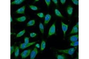 Immunofluorescence analysis of Hela tissue using HSP70 Monoclonal Antibody at dilution of 1:100. (HSP70 Antikörper)