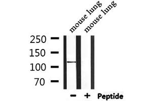 Western blot analysis of extracts from mouse lung, using CEP110 Antibody. (Centriolin Antikörper)