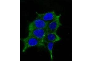 Immunofluorescence testing of LNCaP cells and Alexa Fluor 488 conjugated ODC-1 antibody. (ODC1 Antikörper)