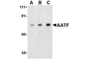 Western blot analysis of AATF in human small intestine cell lysate with AP30004PU-N AATF antibody at (A) 0. (AATF Antikörper)