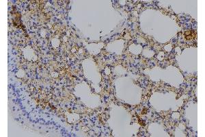 ABIN6276570 at 1/100 staining Mouse lung tissue by IHC-P. (RAB11A Antikörper  (C-Term))